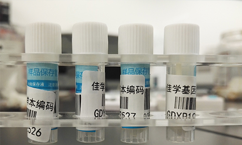 【佳学基因检测】做Bosch-Boonstra-Schaaf视神经萎缩综合征基因解码、<a href=http://www.jiaxuejiyin.com/tk/jiema/cexujishu/2021/31933.html>基因检测</a>需要多长时间?