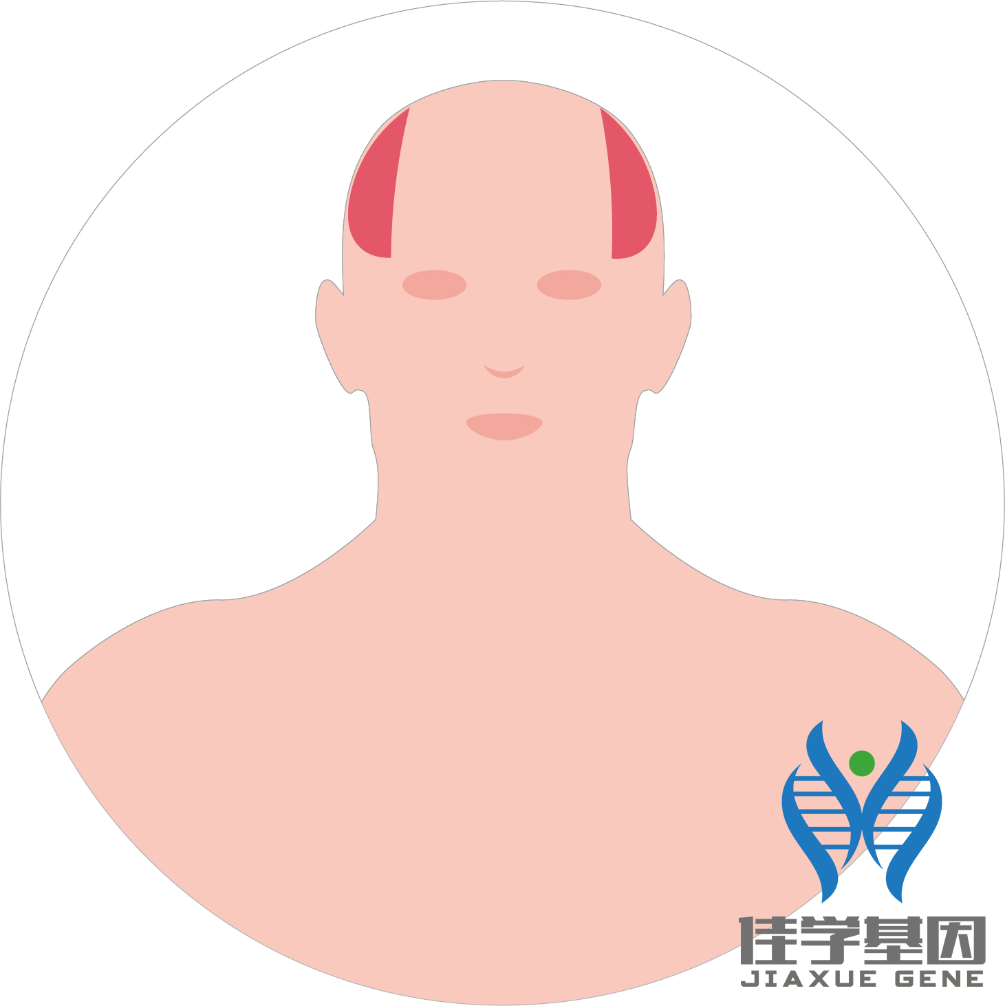 【佳学基因检测】男性<font color='red'>脱发</font>（Androgenetic alopecia）基因解码、<a href=http://www.jiaxuejiyin.com/tk/jiema/cexujishu/2021/31933.html>基因检测</a>