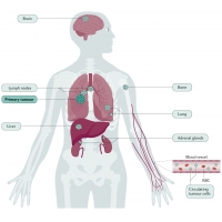 【佳学基因检测】小细胞<font color='red'>肺癌</font>基因检测：知识、背景与依据