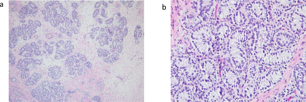 <b>【佳学基因检测】知道TSPO的这些内容，是基因评估分析全面性一个准备</b>