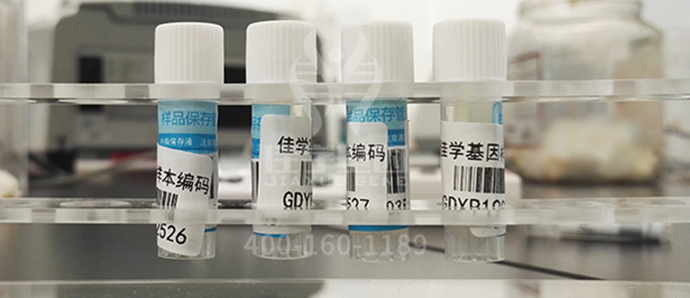 <b>【佳学基因检测】肚子里的胎儿有三个月了，基因检测DAG1突变，该怎么办？</b>