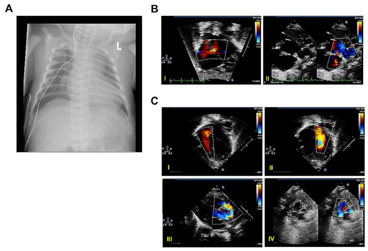 广州马方式综合征基因检测