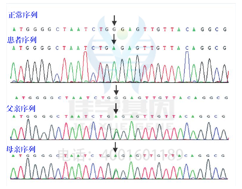 <b>【佳学基因检测】心血管内科突变检测考查中关于EFNB3的要点</b>
