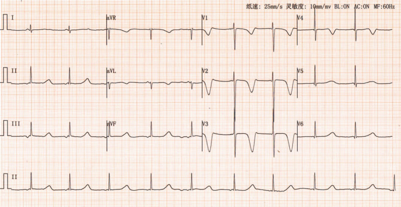 心源性猝死基因检测北京